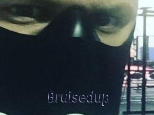 Bruisedup